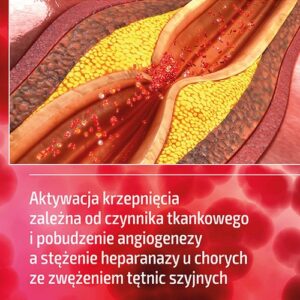 Aktywacja krzepnięcia zależna od czynnika tkankowego i pobudzenie angiogenezy a stężenie heparanazy