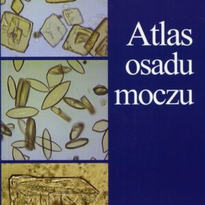 Atlas osadu moczu