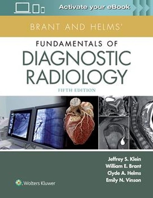 Brant and Helms Fundamentals of Diagnostic Ra
