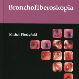 Bronchofiberoskopia