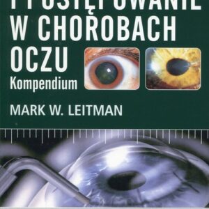 Diagnostyka i postępowanie w chorobach oczu. Kompendium