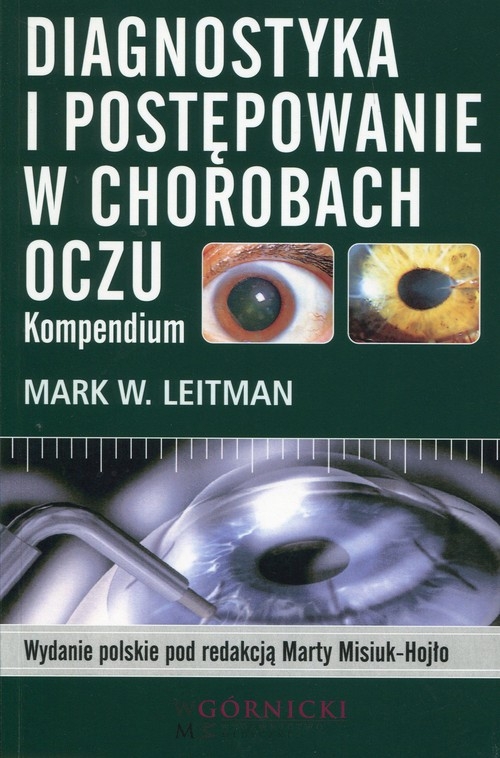Diagnostyka i postępowanie w chorobach oczu. Kompendium