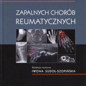 Diagnostyka obrazowa zapalnych chorób reumatycznych