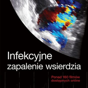Echokardiografia Praktyczna Infekcyjne zapalenie wsierdzia