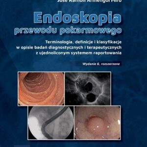 Endoskopia przewodu pokarmowego terminologia definicje i klasyfikacje w opisie badań diagnostycznych