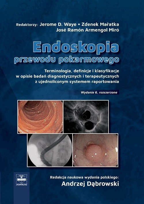Endoskopia przewodu pokarmowego terminologia definicje i klasyfikacje w opisie badań diagnostycznych