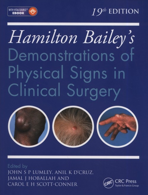 HAMILTON BAILEY PHYSICAL SIGNS
