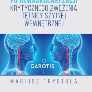 Jakość życia chorych po rewaskularyzacji krytycznego zwężenia tętnicy szyjnej wewnętrznej
