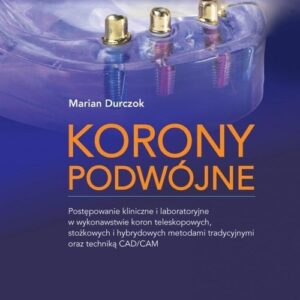 Korony podwójne. Postępowanie kliniczne i laboratoryjne w wykonawstwie koron teleskopowych, stożkowych i hybrydowych metodami tradycyjnymi