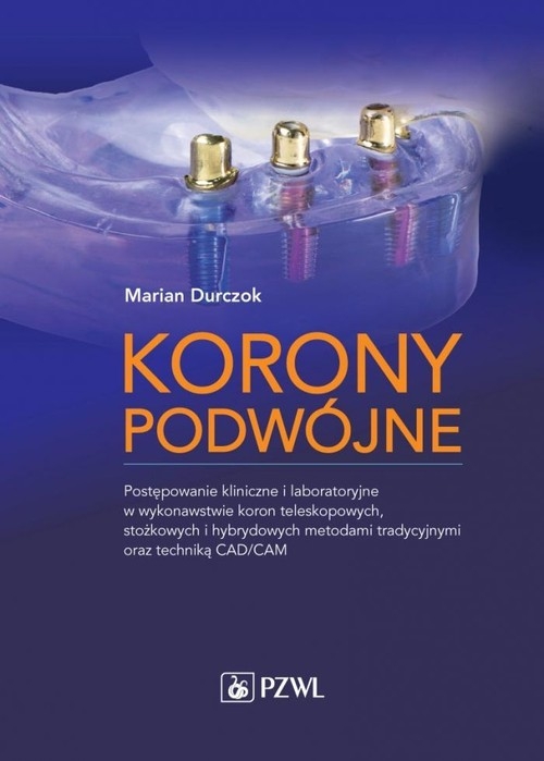 Korony podwójne. Postępowanie kliniczne i laboratoryjne w wykonawstwie koron teleskopowych, stożkowych i hybrydowych metodami tradycyjnymi