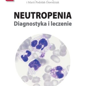 Neutropenia Diagnostyka i leczenie