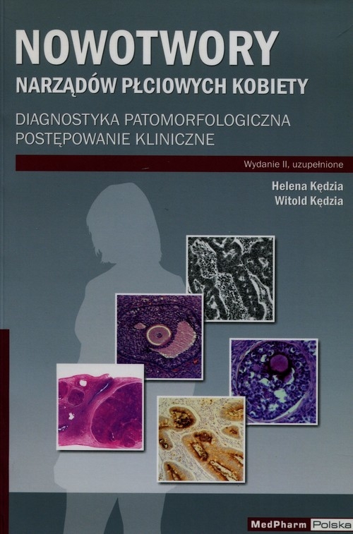 Nowotwory narządów płciowych kobiety. Diagnostyka patomorfologiczna postępowanie kliniczne