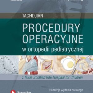 Procedury operacyjne w ortopedii pediatrycznej. Tachdjian