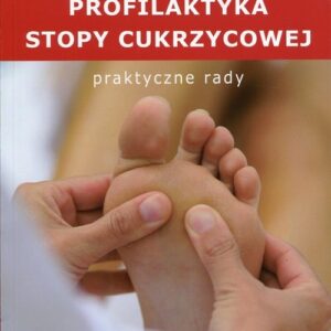Profilaktyka stopy cukrzycowej Praktyczne rady
