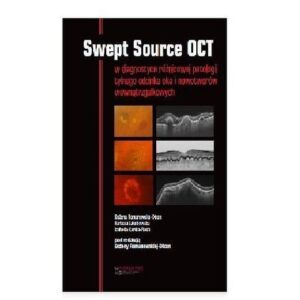 Swept Source OCT w diagnostyce patologii tylne