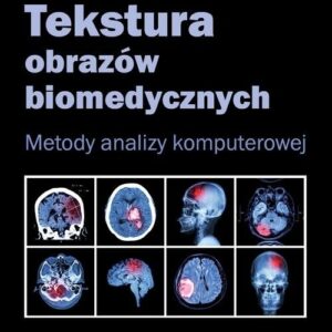 Tekstura obrazów biomedycznych. Metody analizy komputerowej