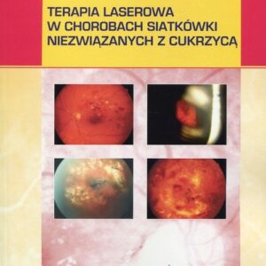 Terapia laserowa w chorobach siatkówki niezwiązanych z cukrzycą