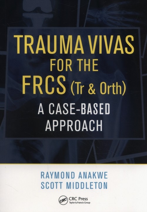 TRAUMA VIVAS FOR THE FRCS