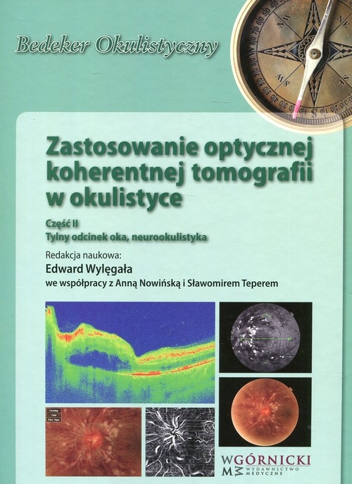Zastosowanie optycznej koherentnej tomografii w okulistyce Część 2. Tylny odcinek oka, neurookulistyka