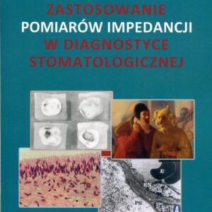 Zastosowanie pomiarów impedancji w diagnostyce stomatologicznej