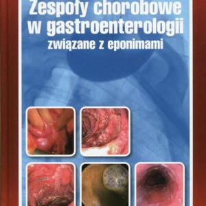 Zespoły chorobowe w gastroenterologii związane z eponimami