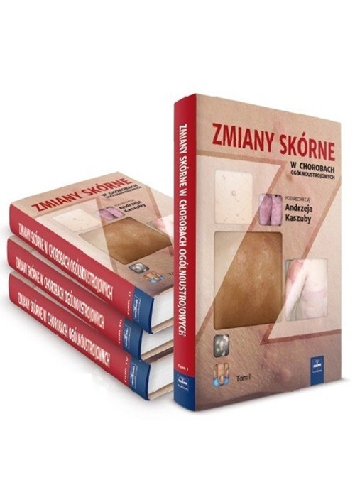 Zmiany skórne w chorobach ogólnoustrojowych Tom 2